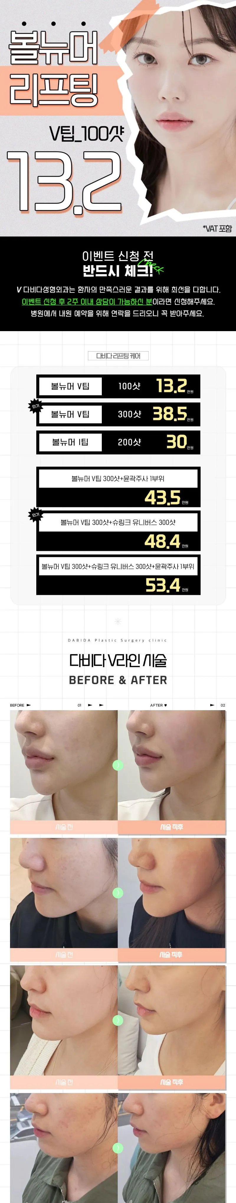 掲載画像 · 다비다성형외과의원 · Cashdoc 掲載画像 · 다비다성형외과의원 · Cashdoc